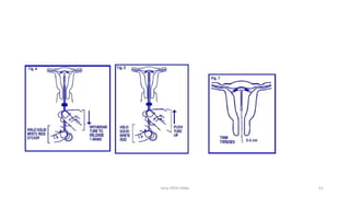 Obg Instruments Ppt instruments ostetrics and gynaecology ppt | PDF
