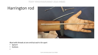 Cd Harrington Rods Instruments orthopaedics for mbbs students | PDF