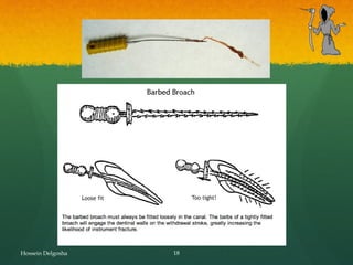 Broach And Rasp Instruments used in endodontic treatment. | PPT