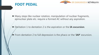  Many steps like nuclear rotation, manipulation of nuclear fragments,
epinuclear plate etc. require a formed AC without any aspiration.
 Dentation 1 to dentation 2 is the aspiration or the IA excursion.
 From dentation 2 to full depression is the phaco or the ‘IAP’ excursion.
FOOT PEDAL
 