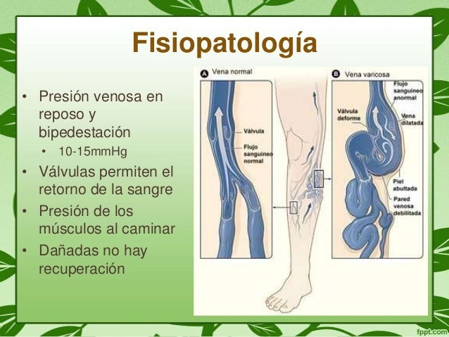 Insuficiencia arterial y venosa