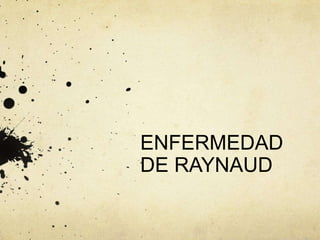 ENFERMEDAD
DE RAYNAUD
 