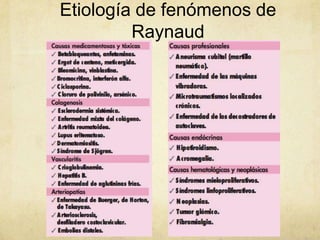 Etiología de fenómenos de
         Raynaud
 