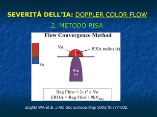 SEVERITÀ DELL’IA:  DOPPLER COLOR FLOW 2. METODO PISA Zoghbi WA et al.  J Am Soc Echocardiogr  2003;16:777-802. 