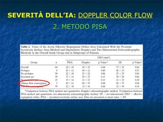 SEVERITÀ DELL’IA:  DOPPLER COLOR FLOW 2. METODO PISA 