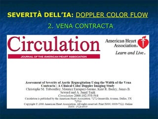 SEVERITÀ DELL’IA:  DOPPLER COLOR FLOW 2. VENA CONTRACTA 