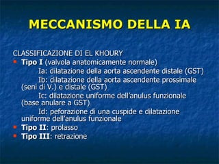 MECCANISMO DELLA IA CLASSIFICAZIONE DI EL KHOURY Tipo I  (valvola anatomicamente normale) Ia: dilatazione della aorta ascendente distale (GST) Ib: dilatazione della aorta ascendente prossimale (seni di V.) e distale (GST) Ic: dilatazione uniforme dell’anulus funzionale (base anulare a GST) Id: peforazione di una cuspide e dilatazione uniforme dell’anulus funzionale  Tipo II : prolasso  Tipo III : retrazione  