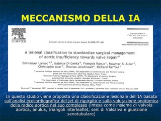 MECCANISMO DELLA IA In questo studio viene proposta una classificazione lesionale dell’IA basata  sull’analisi ecocardiografica del jet di rigurgito e sulla valutazione anatomica della radice aortica nel suo complesso  (intesa come insieme di valvola aortica, anulus, triangoli interleaflet, seni di Valsalva e giunzione senotubulare) 