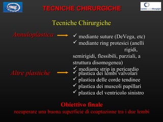 Tecniche ChirurgicheTecniche Chirurgiche
AnnuloplasticaAnnuloplastica  mediante suture (DeVega, etc)mediante suture (DeVe...