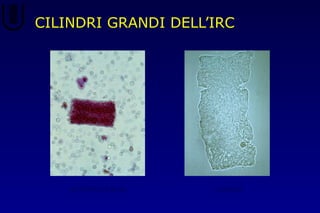 CILINDRI GRANDI DELL’IRC
eritrocitario cereo
 