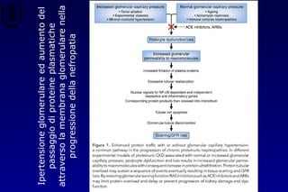 Ipertensioneglomerulareedaumentodel
passaggiodiproteineplasmatiche
attraversolamembranaglomerularenella
progressionedellanefropatia
 