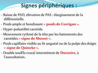 Signes périphériques :
- Baisse de PAD, élévation de PAS : élargissement de la
différentielle.
- Pouls ample et bondissant « pouls de Corrigan ».
- Hyper-pulsatilité carotide.
- Mouvement rythmé de la tête par les battements des
carotides « signe de Musset ».
- Pouls capillaire visible au lit unguéal ou de la pulpe des doigts
« signe de Quincke ».
- Double souffle crural intermittent de Duroziez, à
l'auscultation.
 