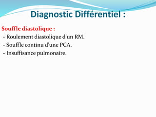 Diagnostic Différentiel :
Souffle diastolique :
- Roulement diastolique d'un RM.
- Souffle continu d'une PCA.
- Insuffisance pulmonaire.
 