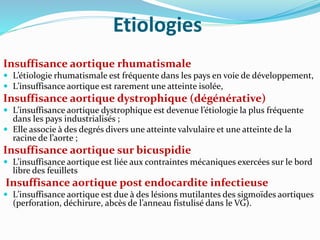 Etiologies
Insuffisance aortique rhumatismale
 L’étiologie rhumatismale est fréquente dans les pays en voie de développement,
 L’insuffisance aortique est rarement une atteinte isolée,
Insuffisance aortique dystrophique (dégénérative)
 L’insuffisance aortique dystrophique est devenue l’étiologie la plus fréquente
dans les pays industrialisés ;
 Elle associe à des degrés divers une atteinte valvulaire et une atteinte de la
racine de l’aorte ;
Insuffisance aortique sur bicuspidie
 L’insuffisance aortique est liée aux contraintes mécaniques exercées sur le bord
libre des feuillets
Insuffisance aortique post endocardite infectieuse
 L’insuffisance aortique est due à des lésions mutilantes des sigmoïdes aortiques
(perforation, déchirure, abcès de l’anneau fistulisé dans le VG).
 