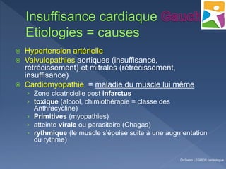  Hypertension artérielle
 Valvulopathies aortiques (insuffisance,
rétrécissement) et mitrales (rétrécissement,
insuffisance)
 Cardiomyopathie = maladie du muscle lui même
› Zone cicatricielle post infarctus
› toxique (alcool, chimiothérapie = classe des
Anthracycline)
› Primitives (myopathies)
› atteinte virale ou parasitaire (Chagas)
› rythmique (le muscle s'épuise suite à une augmentation
du rythme)
Dr Gabin LEGROS cardiologue
 