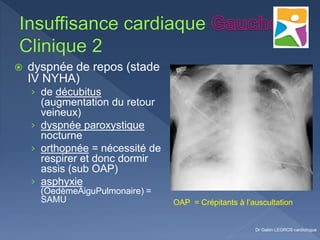  dyspnée de repos (stade
IV NYHA)
› de décubitus
(augmentation du retour
veineux)
› dyspnée paroxystique
nocturne
› orthopnée = nécessité de
respirer et donc dormir
assis (sub OAP)
› asphyxie
(OedèmeAiguPulmonaire) =
SAMU
Dr Gabin LEGROS cardiologue
OAP = Crépitants à l’auscultation
 