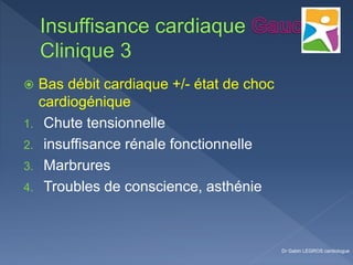  Bas débit cardiaque +/- état de choc
cardiogénique
1. Chute tensionnelle
2. insuffisance rénale fonctionnelle
3. Marbrures
4. Troubles de conscience, asthénie
Dr Gabin LEGROS cardiologue
 