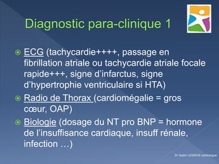  ECG (tachycardie++++, passage en
fibrillation atriale ou tachycardie atriale focale
rapide+++, signe d’infarctus, signe
d’hypertrophie ventriculaire si HTA)
 Radio de Thorax (cardiomégalie = gros
cœur, OAP)
 Biologie (dosage du NT pro BNP = hormone
de l’insuffisance cardiaque, insuff rénale,
infection …)
Dr Gabin LEGROS cardiologue
 