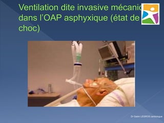 Dr Gabin LEGROS cardiologue
 