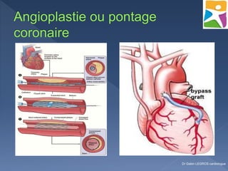 Dr Gabin LEGROS cardiologue
 