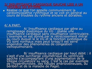 3/ INSUFFISANCE CARDIAQUE GAUCHE LIEE A UN
TROUBLE DU RYTHME.
 Réalise ce que l’on appelle communément la
cardiomyopathie rythmique et se voit en général au
cours de troubles du rythme anciens et durables.
4/ A PART.
A/ Insuffisance cardiaque par gêne au
remplissage diastolique du VG : réalise une
insuffisance cardiaque sans insuffisance ventriculaire.
L’exemple en est donné par le rétrécissement mitral
au cours duquel le le VG et la fonction systolique du
VG sont normaux mais peut lorsqu’il est serré
engendrer des phénomènes de congestion
veinopulmonaire.
B/ insuffisance cardiaque par haut débit : il
s’agit d’une surcharge volumétrique du ventricule
gauche s’accompagnant d’une augmentation de la
vitesse circulatoire su sang. C’est le cas par exemple
de l’hyperthyroïdie, des fistules artérioveineuses, du
béribéri et de la maladie de Paget.
 