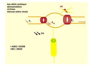 Pcg
FG
bas débit cardiaque
déshydratation
cirrhose
sténose artère rénale
P1
P2
AII
+ AINS / COXIB
+IEC / ARAII
 