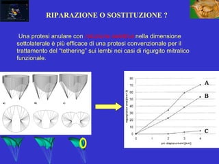 RIPARAZIONE O SOSTITUZIONE ?
Una protesi anulare con riduzione selettiva nella dimensione
settolaterale è più efficace di una protesi convenzionale per il
trattamento del “tethering” sui lembi nei casi di rigurgito mitralico
funzionale.
 