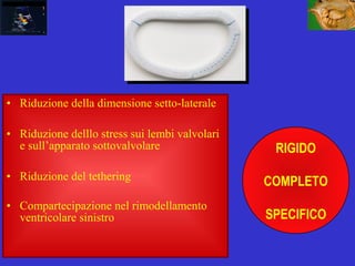• Riduzione della dimensione setto-laterale
• Riduzione delllo stress sui lembi valvolari
e sull’apparato sottovalvolare
• Riduzione del tethering
• Compartecipazione nel rimodellamento
ventricolare sinistro
RIGIDO
COMPLETO
SPECIFICO
 
