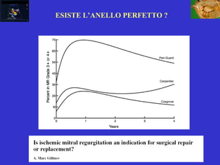 ESISTE L’ANELLO PERFETTO ?
 