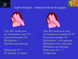 Tipo IIIb lembo postTipo IIIb lembo post Tipo IIIb lembi post e antTipo IIIb lembi post e ant
Jet Asimmetrico post P3 ++Jet Asimmetrico post P3 ++ Jet Simmetrico centrale P2 P3Jet Simmetrico centrale P2 P3
Locale distorsione VSLocale distorsione VS Distorsione globale VSDistorsione globale VS
IM inferiore ++IM inferiore ++ IM InferioreIM Inferiore ±± IM anterioreIM anteriore
Papillare post dislocatoPapillare post dislocato MPapillare postMPapillare post ±± dislocatodislocato
MPapillare ant dislocatoMPapillare ant dislocato
Dilatazione VS +Dilatazione VS + Dilatazione VS +++Dilatazione VS +++
FE normale or ridottaFE normale or ridotta FE depressaFE depressa
Aspetti chirurgici : valutazione del Jet di rigurgito
 
