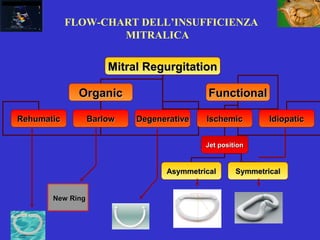 Mitral RegurgitationMitral Regurgitation
OrganicOrganic FunctionalFunctional
RehumaticRehumatic BarlowBarlow DegenerativeDegenerative IschemicIschemic IdiopaticIdiopatic
Jet positionJet position
AsymmetricalAsymmetrical SymmetricalSymmetrical
New RingNew Ring
FLOW-CHART DELL’INSUFFICIENZA
MITRALICA
 