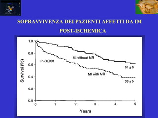 SOPRAVVIVENZA DEI PAZIENTI AFFETTI DA IM
POST-ISCHEMICA
 