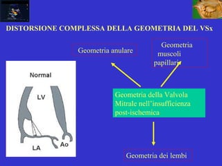 DISTORSIONE COMPLESSA DELLA GEOMETRIA DEL VSx
Geometria della Valvola
Mitrale nell’insufficienza
post-ischemica
Geometria anulare
Geometria
muscoli
papillari
Geometria dei lembi
 