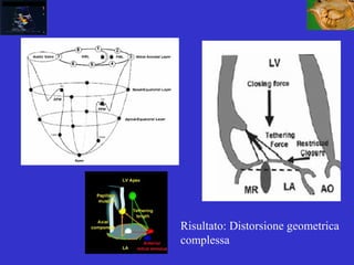 Risultato: Distorsione geometrica
complessa
 