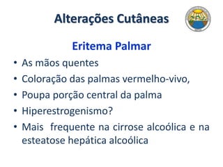 Alterações Cutâneas
Eritema Palmar
• As mãos quentes
• Coloração das palmas vermelho-vivo,
• Poupa porção central da palma
• Hiperestrogenismo?
• Mais frequente na cirrose alcoólica e na
esteatose hepática alcoólica
 