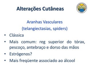 Alterações Cutâneas
Aranhas Vasculares
(telangiectasias, spiders)
• Clássica
• Mais comum: reg superior do tórax,
pescoço, antebraço e dorso das mãos
• Estrógenos?
• Mais freqüente associado ao álcool
 