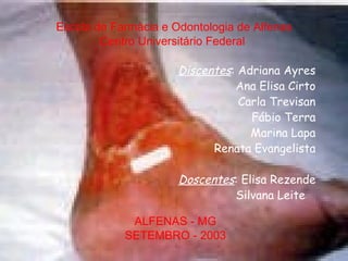 Escola de Farmácia e Odontologia de Alfenas Centro Universitário Federal  ALFENAS - MG SETEMBRO - 2003 Discentes : Adriana Ayres Ana Elisa Cirto Carla Trevisan Fábio Terra Marina Lapa Renata Evangelista Doscentes : Elisa Rezende Silvana Leite  