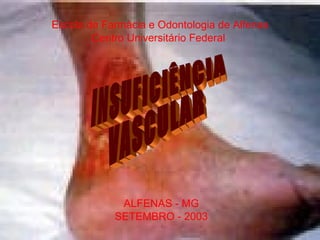 Escola de Farmácia e Odontologia de Alfenas Centro Universitário Federal  INSUFICIÊNCIA VASCULAR ALFENAS - MG SETEMBRO - 2003 