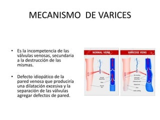 MECANISMO DE VARICES
• Es la incompetencia de las
válvulas venosas, secundaria
a la destrucción de las
mismas.
• Defecto idiopático de la
pared venosa que produciría
una dilatación excesiva y la
separación de las válvulas
agregar defectos de pared.
 