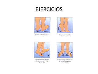 EJERCICIOS
 