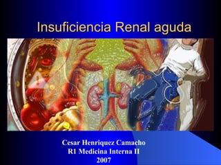 Insuficiencia Renal aguda Cesar Henriquez Camacho R1 Medicina Interna II 2007 