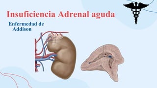 Insuficiencia Adrenal aguda
Enfermedad de
Addison
 