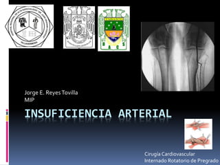 INSUFICIENCIA ARTERIAL
Jorge E. ReyesTovilla
MIP
Cirugía Cardiovascular
Internado Rotatorio de Pregrado
 
