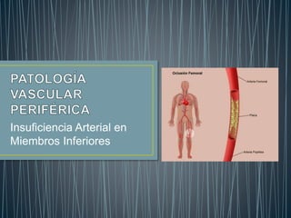Insuficiencia Arterial en
Miembros Inferiores
 
