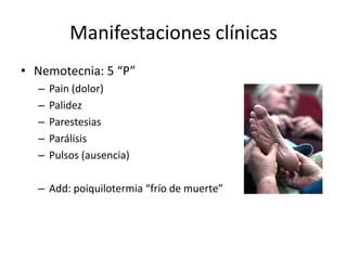 Manifestaciones clínicasNemotecnia: 5 “P”Pain (dolor)PalidezParestesiasParálisisPulsos (ausencia)Add: poiquilotermia “frío de muerte”
