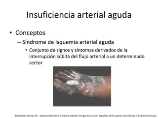 Insuficiencia arterial agudaConceptosSíndrome de Isquemia arterial agudaConjunto de signos y síntomas derivados de la interrupción súbita del flujo arterial a un determinado sectorBallesteros Pomar, M. , Vaquero Morillo, F. Embolia arterial; Cirugía Asociación Española de Cirujanos 2da edición, Edit Panamericana