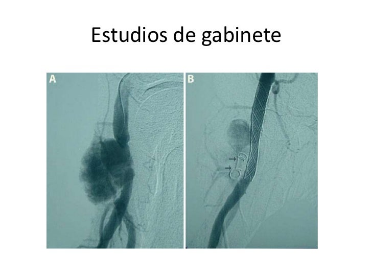 El centro de la cirugía vascular en moskve por ello myasnikova
