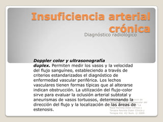 Insuficiencia arterial
                   crónica
         Diagnóstico radiológico




Doppler color y ultrasonografía
dup...