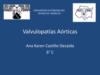 Valvulopatías Aórticas
Ana Karen Castillo Desaida
6° C
UNIVERSIDAD AUTÓNOMA DEL
ESTADO DE MORELOS
 