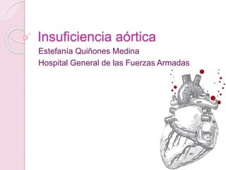 Insuficiencia aórtica
Estefanía Quiñones Medina
Hospital General de las Fuerzas Armadas
 